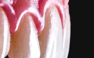 Qu&rsquo;est ce que la parodontologie ?