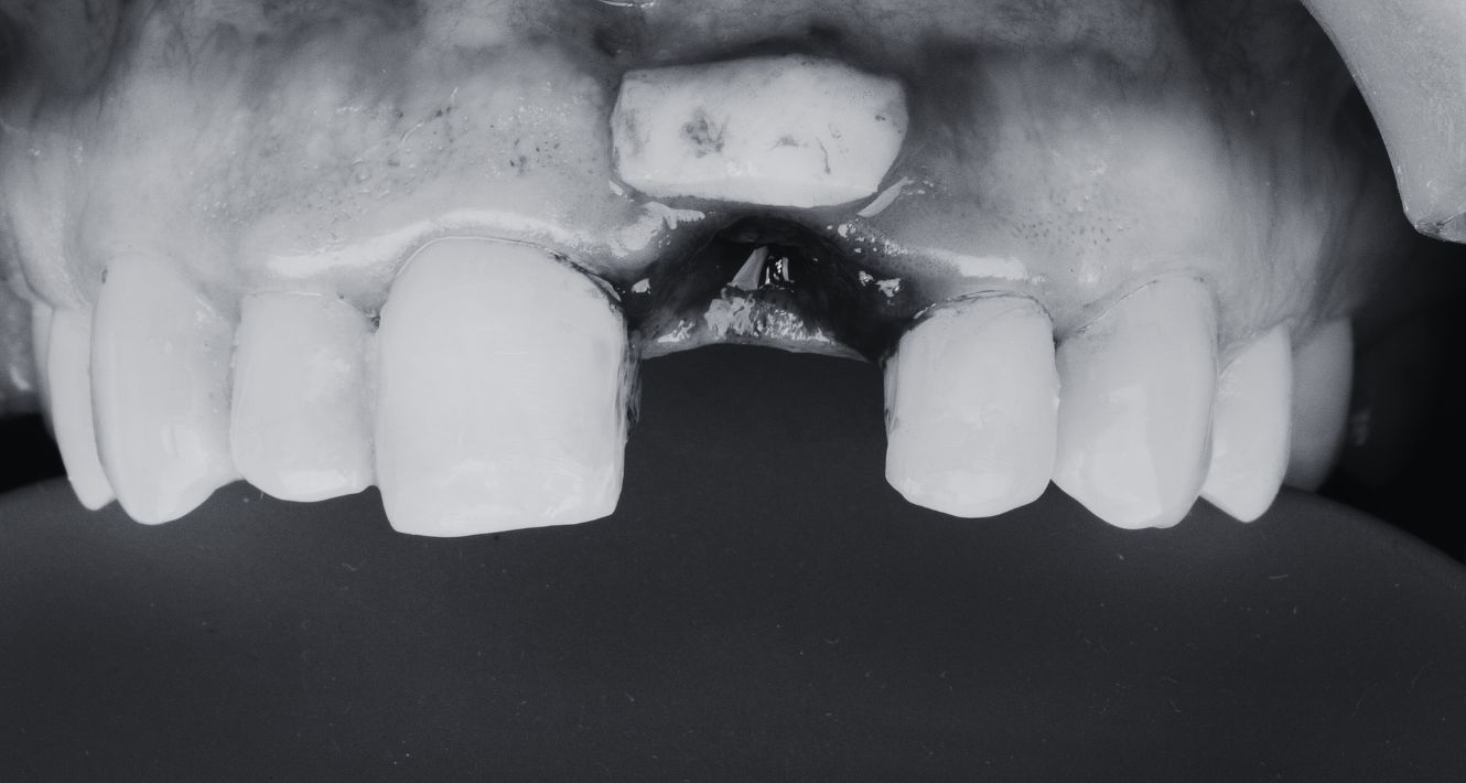 cabinet dentaire plana toulouse - parodontologie