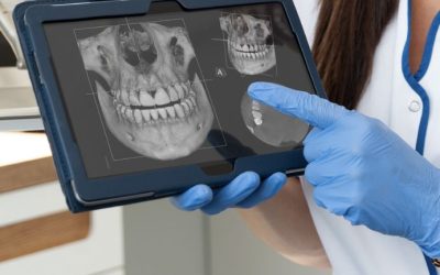 Les nouvelles technologies en dentisterie : comment elles améliorent vos soins dentaires