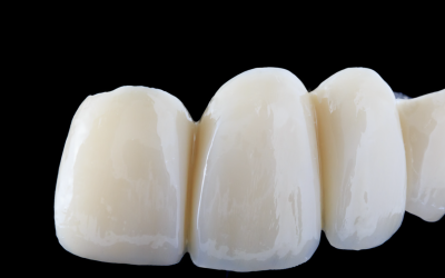 Les gestes d’hygiène essentiels pour prévenir les maladies parodontales