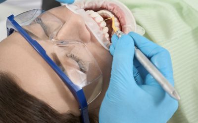 L&rsquo;IMPORTANCE DU DÉTARTRAGE RÉGULIER POUR LA SANTÉ DE VOS GENCIVES