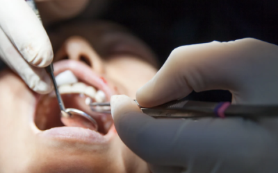 La chirurgie buccale à Toulouse : Quand et pourquoi la considérer ?