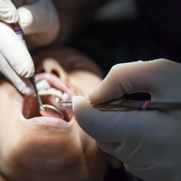 chirurgie buccale à Toulouse