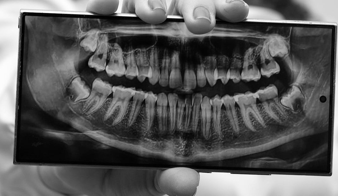 Dentiste expliquant une radiographie dentaire panoramique à un patient sur un écran