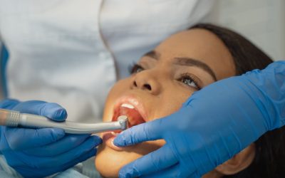 Piercing buccal : ce que vous risquez vraiment pour vos dents et vos gencives
