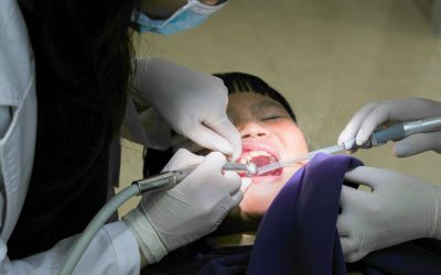 Devis dentaire : restauration, prothèse, réfection… ce que chaque terme veut vraiment dire